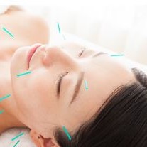 ♥ GW も治療中 ♥ 期間中 美容鍼灸50%OF